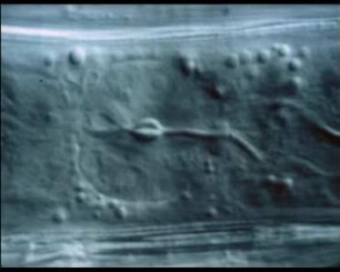 Heterodera schachtii (Nematoda) - Verhalten im Innern von Wurzeln (Raps)