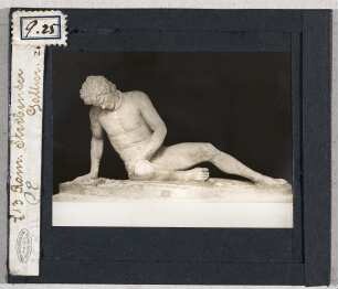 Sterbender Gallier. Rom, Kapitolinische Museen