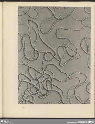 Kurven aus Kugeln. Kettenalge Nostoc. 900:1