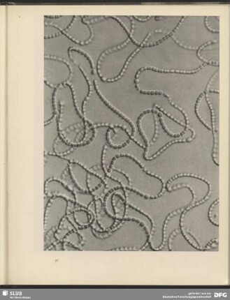 Kurven aus Kugeln. Kettenalge Nostoc. 900:1