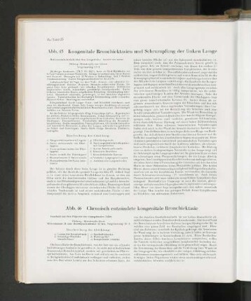 Abb. 46 Chronisch entzündete kongenitale Bronchiektasie