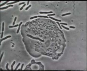 Phagocytose von Bakterien - Amöbe (Hartmannella castellanii)