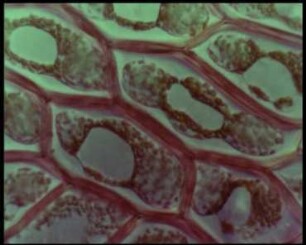 Osmotische Erscheinungen bei Pflanzenzellen: Plasmolyse Zytorrhyse Hookeria lucens (Musci)