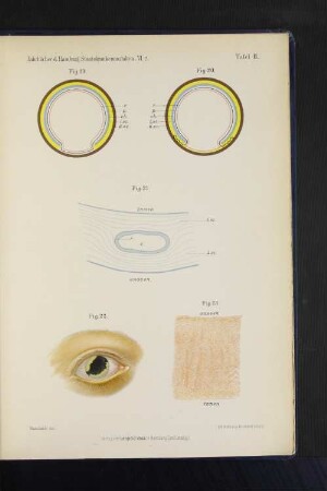 Jahrbücher d. Hamburg. Staatskrankenanstalten. VI. 2. Tafel III.
