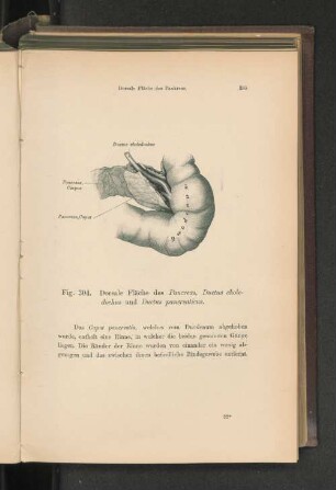 Fig. 304. Dorsale Fläche des Pankreas.