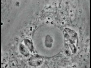 Toxoplasma gondii - Entwicklung proliferativer Formen in Zellkulturen