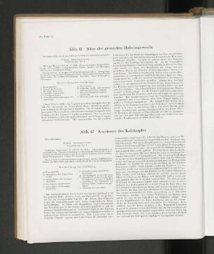 Abb. 42 Karzinom des Kehlkopfes