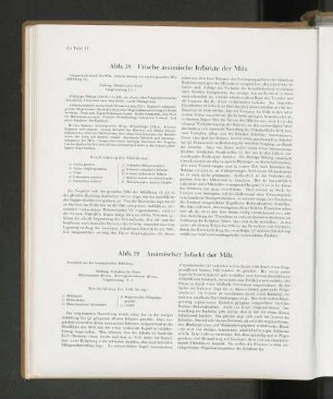 Abb. 19 Anämischer Infarkt der Milz