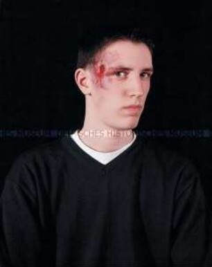 Junger Mann mit geschminkter Gesichtsverletzung (Sonderthema: Ein Bild von mir - Selbstporträts und Selbstdarstellungen)