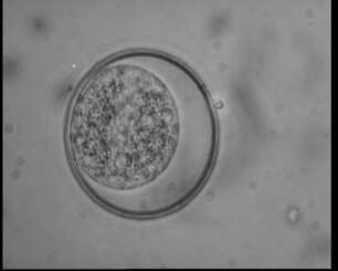 Isospora sylvianthina (Sporozoa) - Exogene Entwicklungsphase (Sporulation)