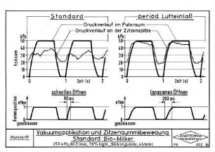 Vakuumapplikation und Zitzengummibewegung Standard: Bio-Milker