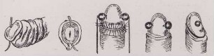 Abbildung verschiedener Genitalpiercings (Zeichnung)