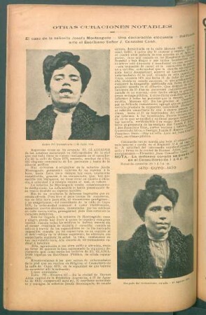 Otras curaciones notables - El caso de la señorita Josefa Monteagudo [...]