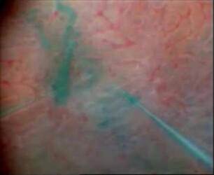 Post-Ischemic Acute Renal Failure (Tupaia belangeri, Rattus norvegicus)