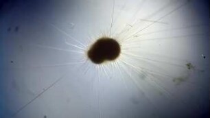 Globigerinella siphonifera, Lanzarote 2022