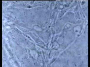 Structure of the endoplasmic reticulum