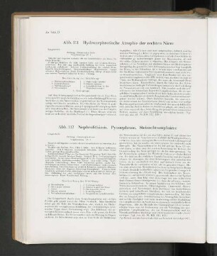 Abb. 112 Nephrolithiasis. Pyonephrose. Steinschrumpfniere