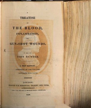 A treatise on the blood inflammation and gun-shot wounds