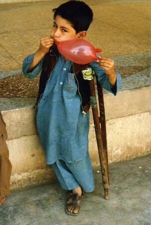 Afghanisches Minenopfer : Der kleine afghanische Junge hat durch sowjetische Minen ein Bein verloren. Er lebt in einem Flüchtlingslager in Pakistan. Aufgenommen 1986 in Quetta