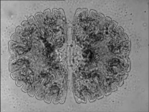 Differenzierung und Wachstum von Micrasterias denticulata (Conjugatae)