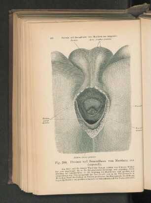Fig. 388. Prostata und Samenblasen vom Mastdarm aus dargestellt.