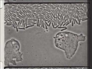 Development of Didymium (Myxomycetes) - Amoeba Phase