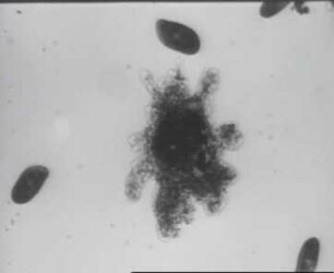 Phagocytose von Paramecien - Amöbe (Amoeba proteus)