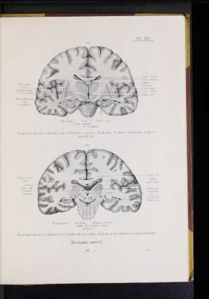 182 Frontalschnitt des Gehrins durch Cauda nuclei caudati, Thalamus und Beginn des Hirnschenkels.