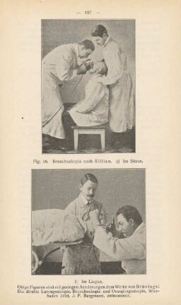 Bronchoskopie nach Killian