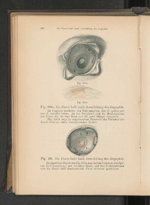 Fig. 100. Die Fascia bulbi nach Ausschälung des Augapfels.