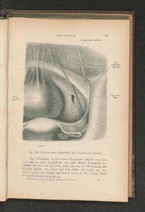 Fig. 529. Peritonaeales Divertikel des Canalis obturatorius.