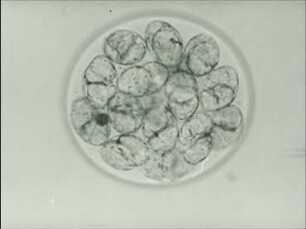 Dissodinium pseudocalani (Dinophyceae) - Vegetative Vermehrung
