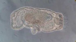 Phoronis muelleri, actinotrocha larva, Helgoland 2014