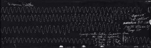 [Graphical recordings: respiration]