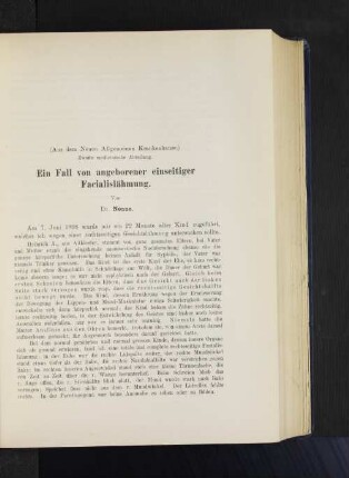 (Aus dem Neuen Allgemeinen Krankenhause.) Zweite medicinische Abteilung. Ein Fall von angeborener einseitiger Facialislähmung. Von Dr. Nonne.