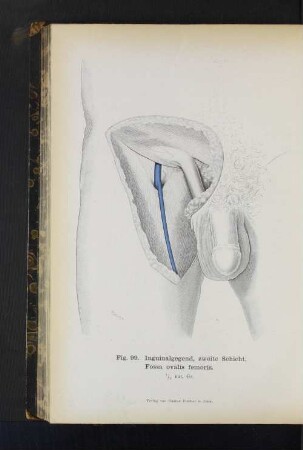 Fig. 99. Inguinalgegend, zweite Schicht. Fossa ovalis femoris.