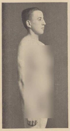 Fotografie eines 19jährigen Mannes (1)