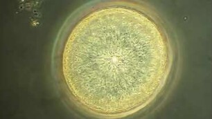 Coscinodiscus wailesii Sylt 2016
