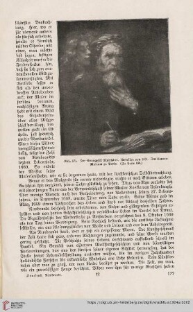 (Abb. 171 - 175)