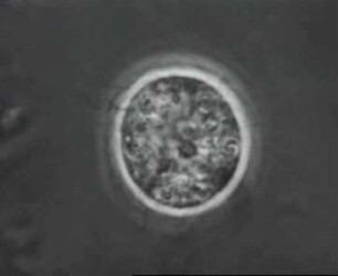 Herpes-simplex-Virus (Stamm H 24) - Cytopathische Veränderungen in der Gewebekultur (Mäusefibroblasten und HEp-2)