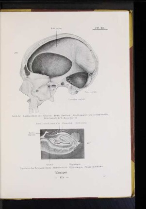 236 Seitlicher Sagittalschnitt des Schädels. Harte Hirnhaut. Großhirnsichel und Kleinhirnsichel. Kleinhirnzelt halb abgeschnitten.