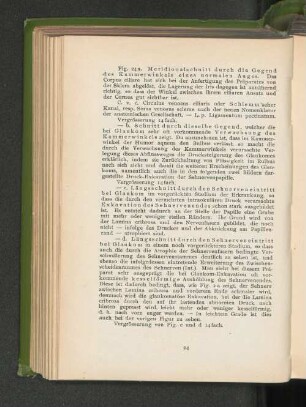 Fig. 24 a. Meridionalschnitt durch die Gegend des Kammerwinkels eines normalen Auges. Fig. 24 b. Schnitt durch dieselbe Gegend. Fig. 24 c. Längsschnitt durch den Sehnerveneintritt bei Glaukom. Fig. 24 d. Längsschnitt durch den Sehnerveneintritt bei Glaukom.