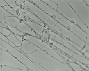 Lieberkühnia wageneri (Testacea) - Bewegung und Fortpflanzung