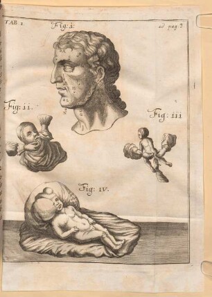 Praxis medicinae infallibilis : e principiis mechanicis dispensationi publicae aeque ac domesticae applicata & archiatrorum felicissimorum consiliis ill.. [1.] (1711)