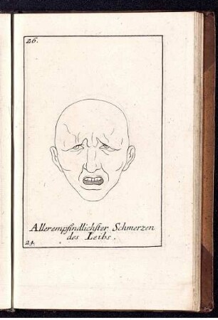 Allerempfindlichster Schmerzen des Leibs.