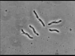 Bdellovibrio bacteriovorus (Pseudomonadaceae) - Parasitischer Befall und Lysis von Spirillum serpens