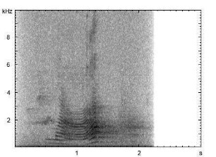 Beo | Gracula religiosa - Imitation der menschlichen Sprache