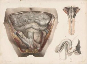 Anatomie der Harnwege beim Mann