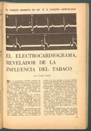 El electrocardiograma, revelador de la influencia del tabaco : El tabaco aumenta en un 75% nuestra mortalidad