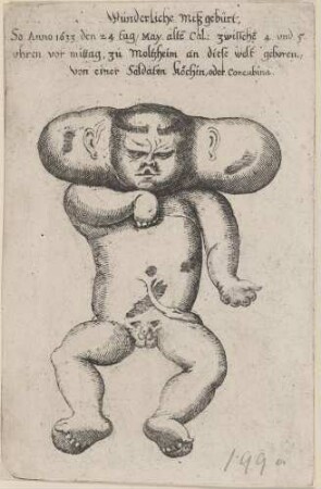 Wunderliche Mißgebürt/ So Anno 1633 den 24 tag May alte Cal: zwische 4. und 5./ uhren vor mittag, zu Moltzheim an diese welt geboren/ von einer Soldaen köchin, oder concubina.